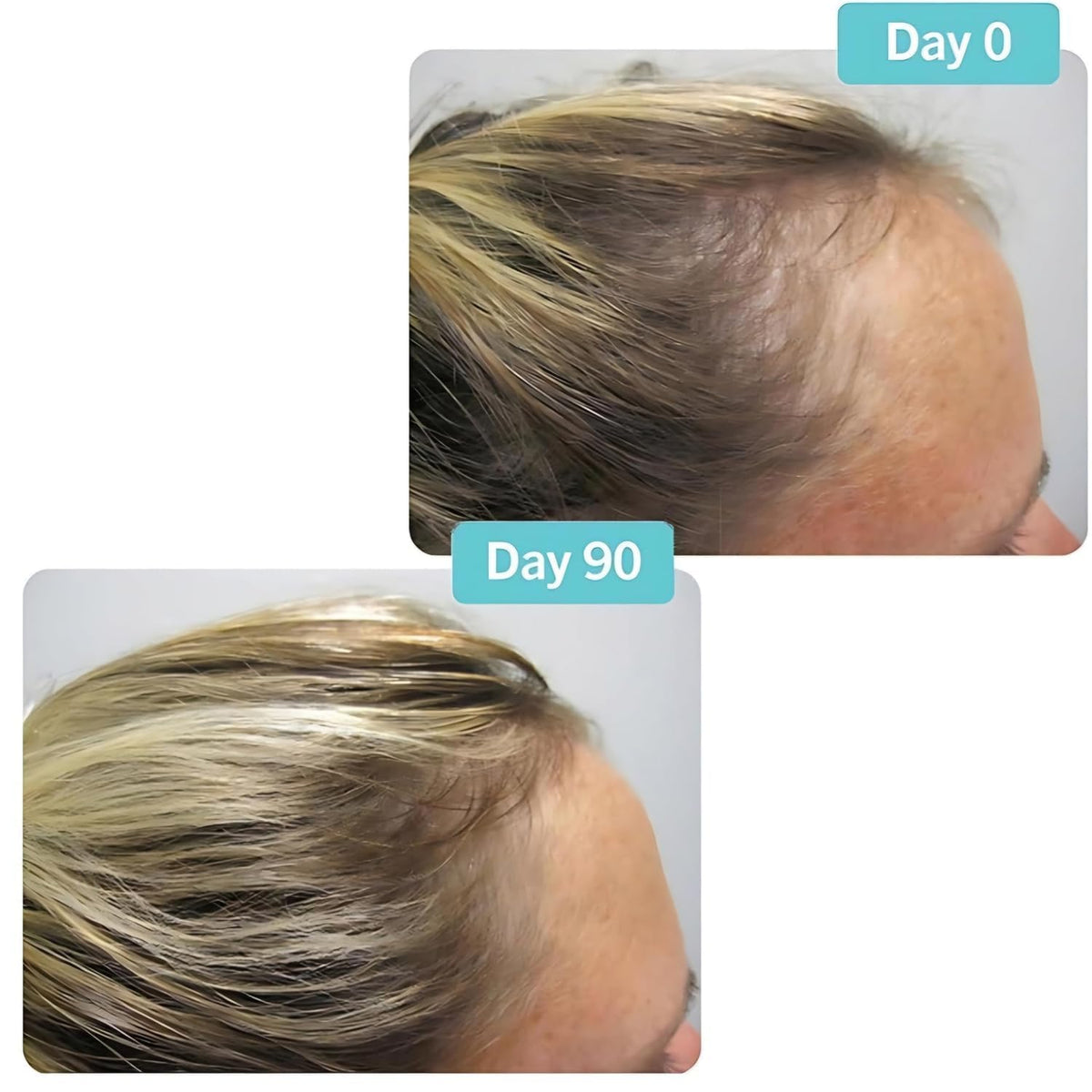 Hair Growth Supplement 180 Tablets A25586